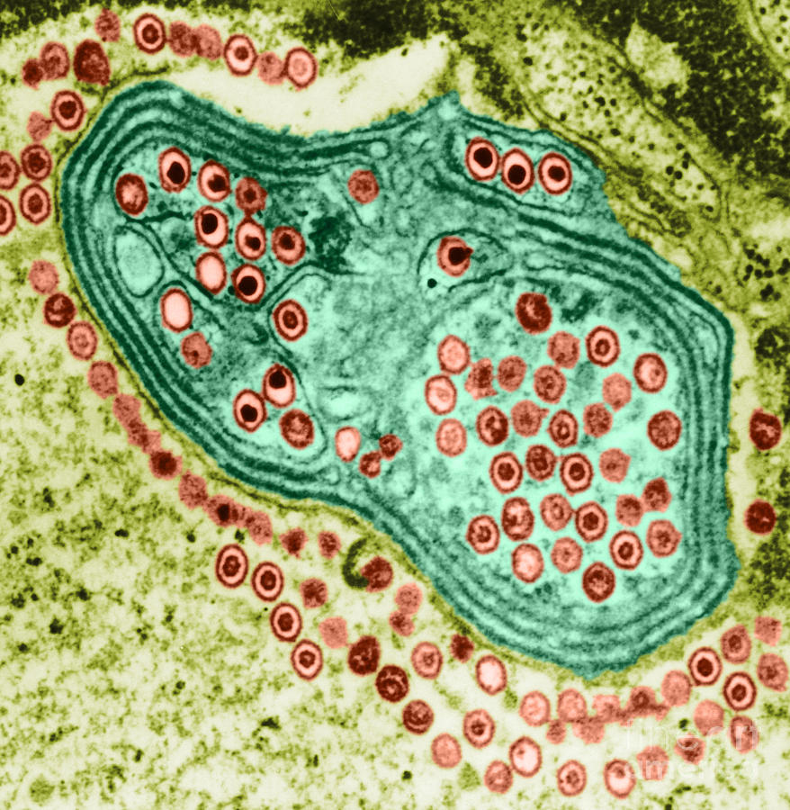 Herpes Simplex Virus, Tem #7 Photograph by Science Source