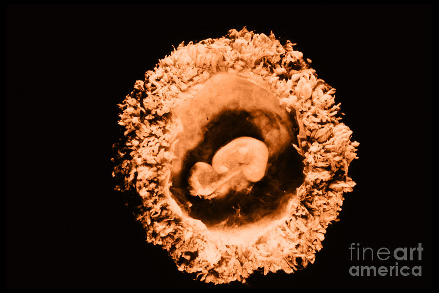 Egg Photograph - Human Embryo #7 by Omikron