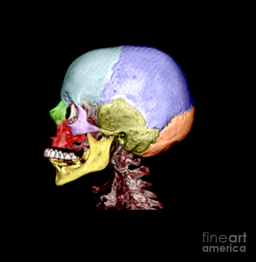 Skull Photograph - Human Skull #7 by Medical Body Scans