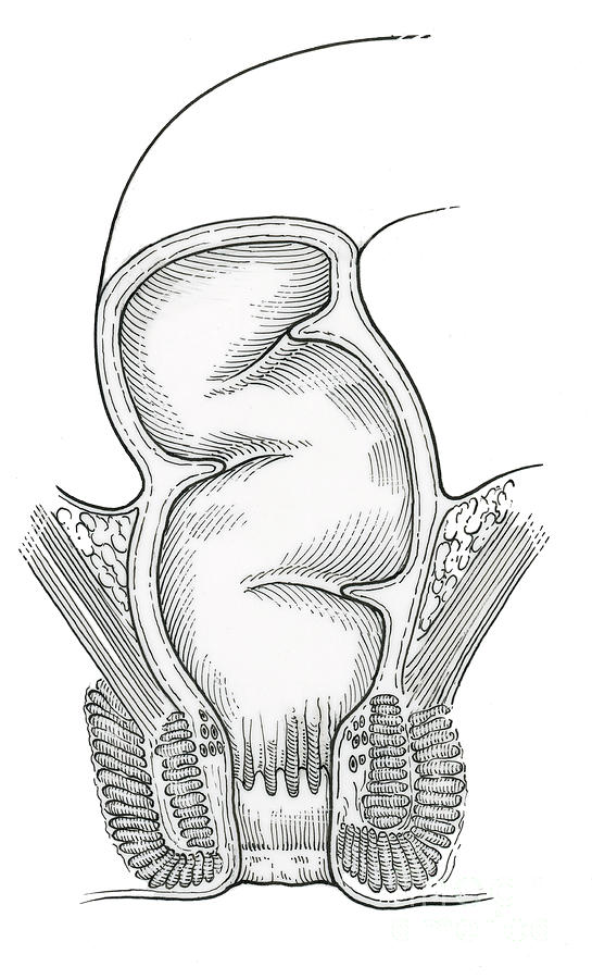 Illustration Of Rectum Photograph by Science Source
 Rectum Drawing