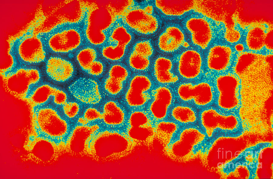 Pathology Photograph - Influenza, A Virus #7 by Science Source