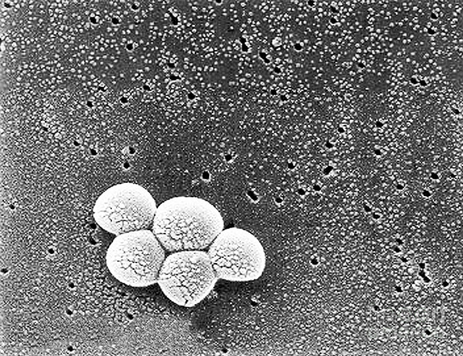 Methicillin-resistant Staphylococcus Photograph By Science Source