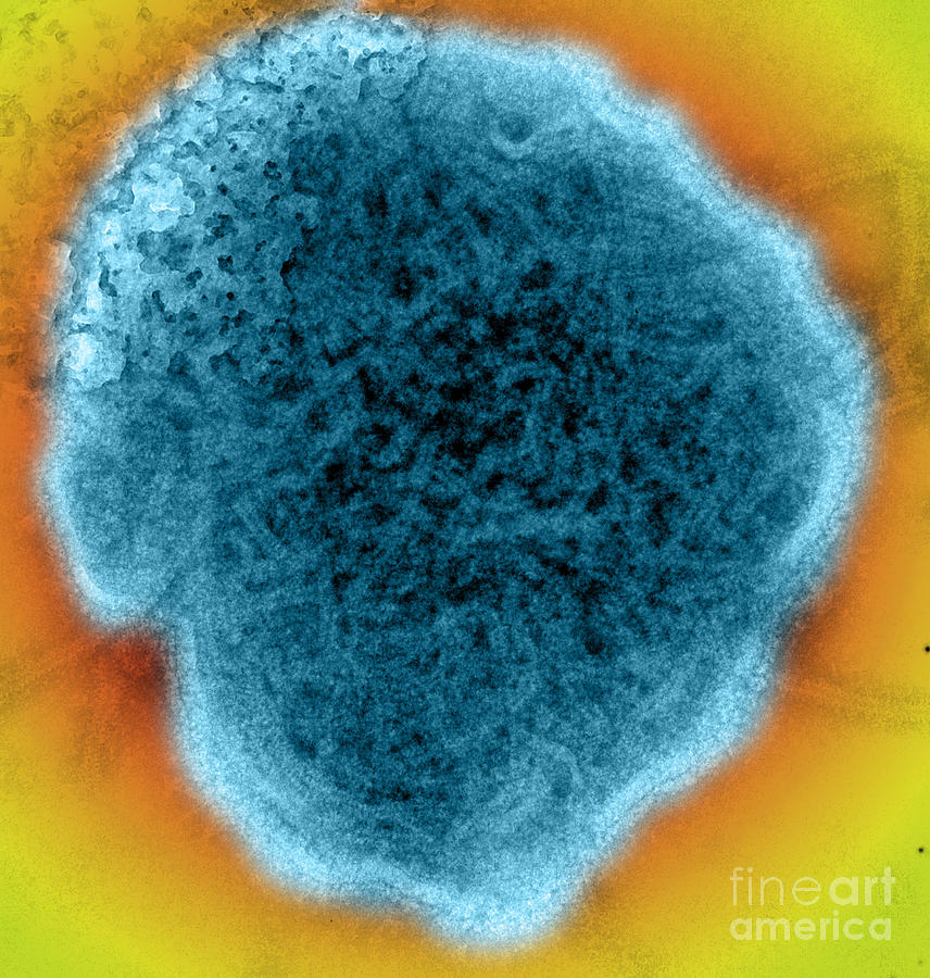 Mumps Virus, Tem #7  by Science Source