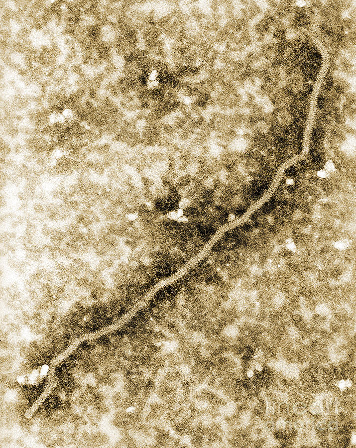 Nipah Virus #7 Photograph by Science Source