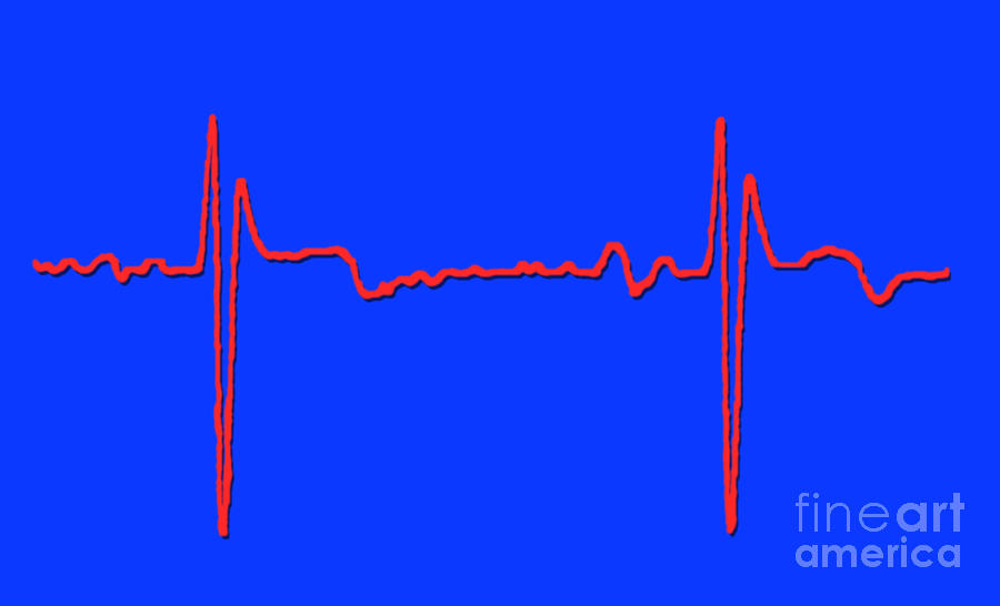 Normal Ecg #7 Photograph by Science Source