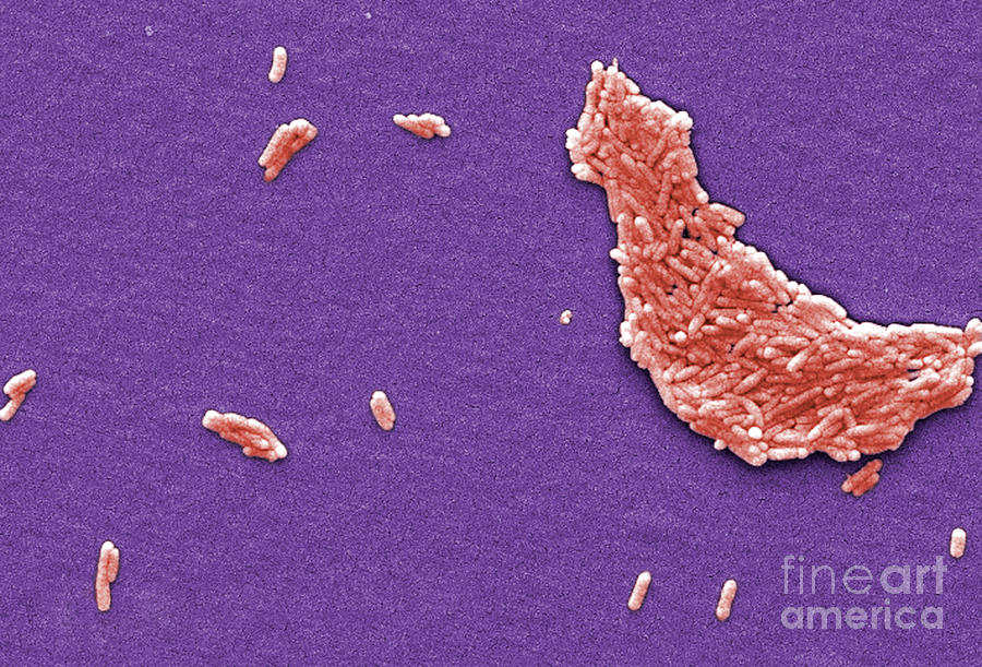 Salmonella, Sem #7 Photograph by Science Source