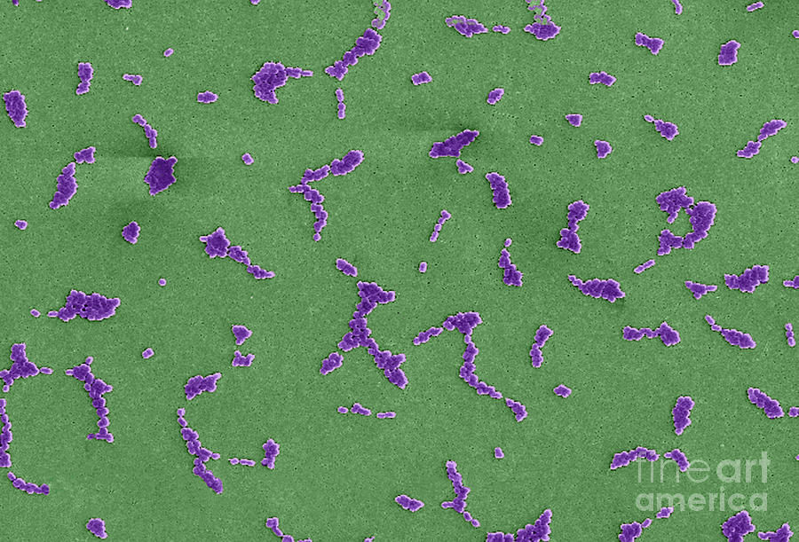 Acinetobacter Baumannii Bacteria, Sem #8 Photograph by Science Source