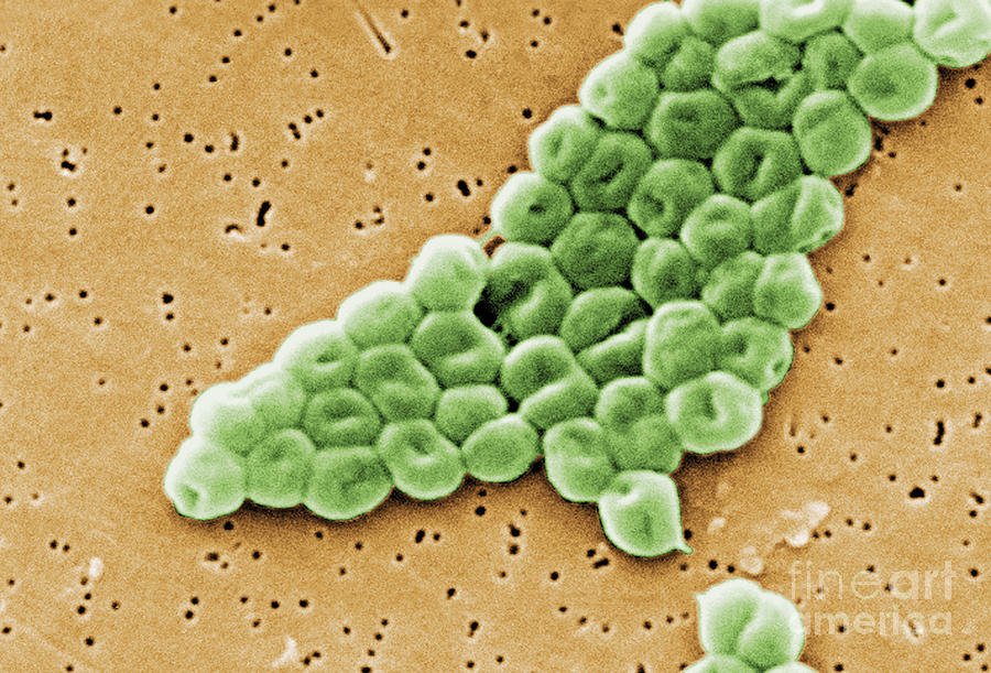 Acinetobacter Baumannii, Sem #8 Photograph by Science Source