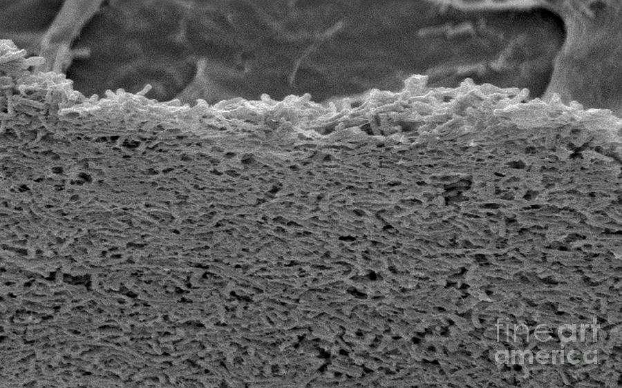 Clostridium Difficile Bacteria, Sem #8 Photograph by Science Source