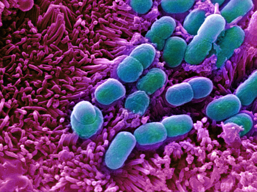 Escherichia Coli Photograph - E. Coli Bacteria, Sem #8 by Stephanie Schuller