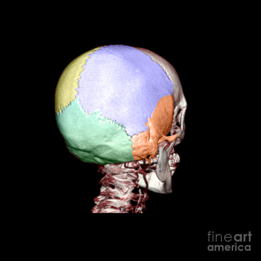 Human Skull #8 Photograph by Medical Body Scans