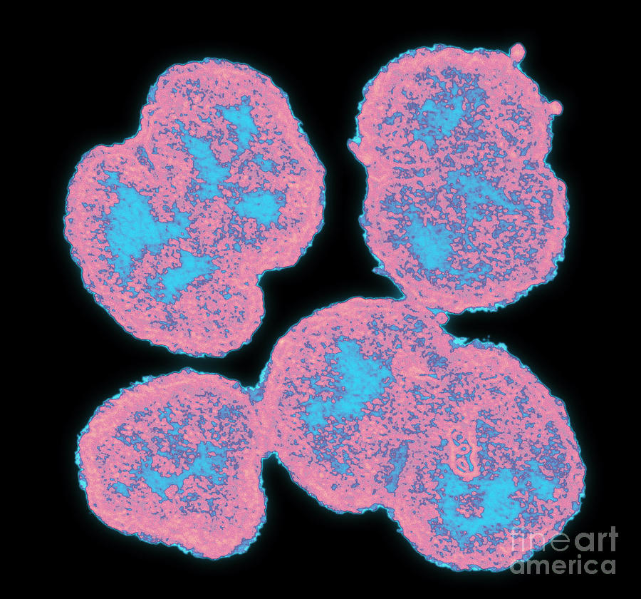Neisseria Gonorrhoeae #8 Photograph by Science Source
