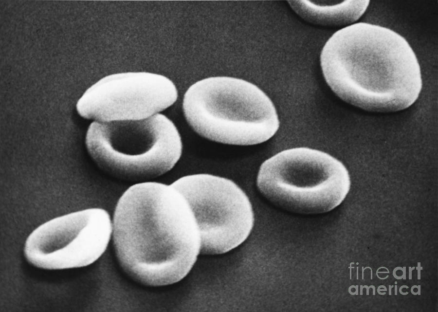 Sem Photograph - Red Blood Cells, Sem #8 by Omikron