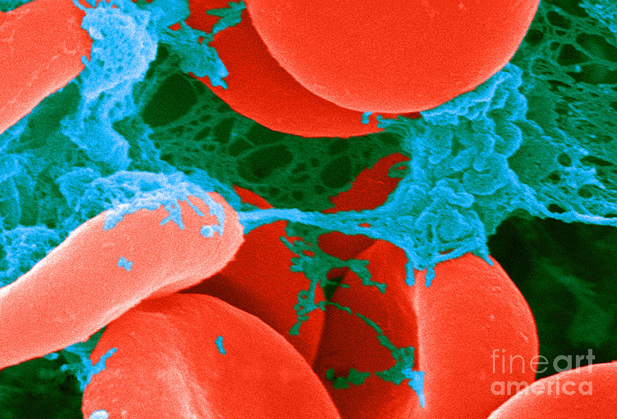 Red Blood Cells, Sem #8 Photograph by Science Source