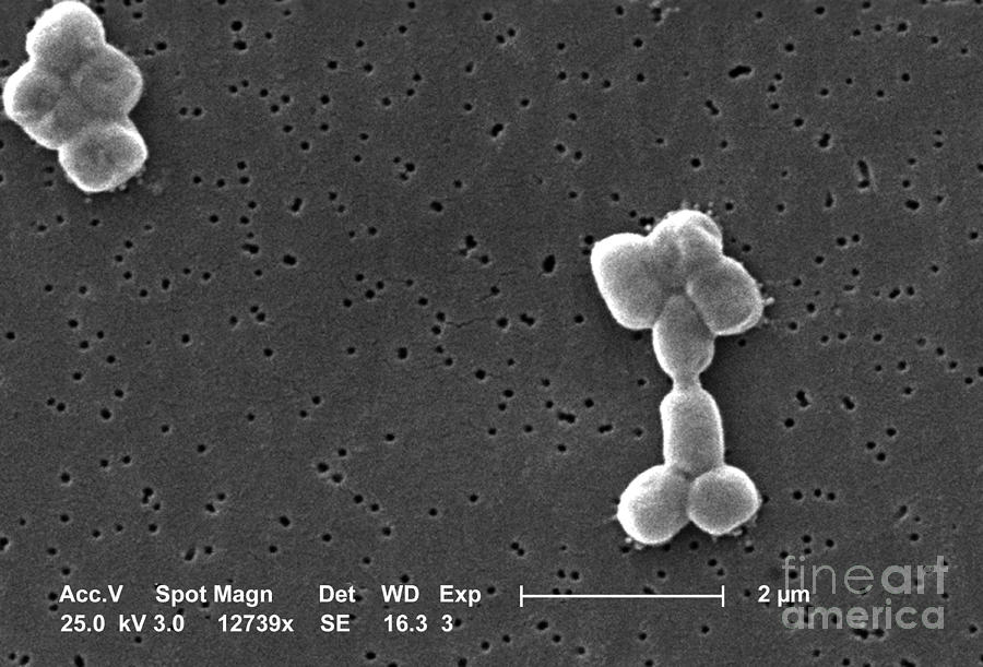 Acinetobacter Baumannii Bacteria, Sem #9 Photograph by Science Source