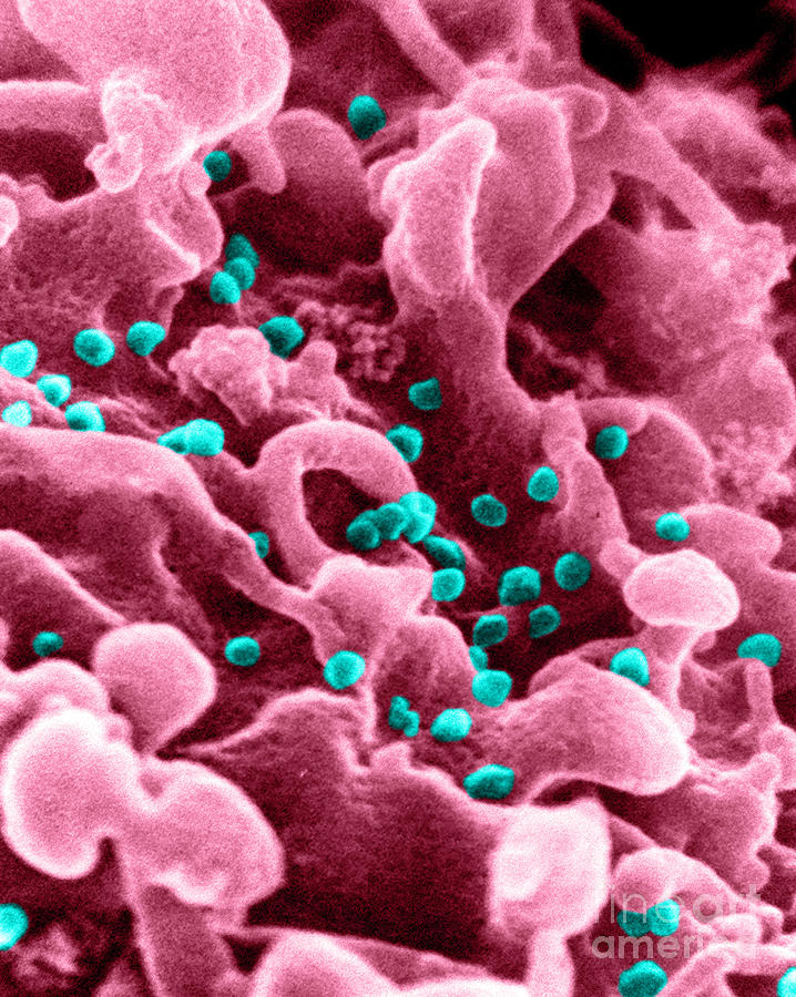 Aids Virus #9 Photograph by Science Source