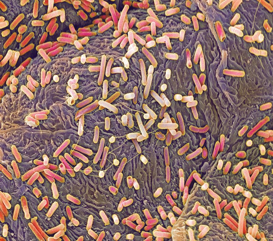 E Coli Photograph - E. Coli Bacteria, Sem #9 by Steve Gschmeissner