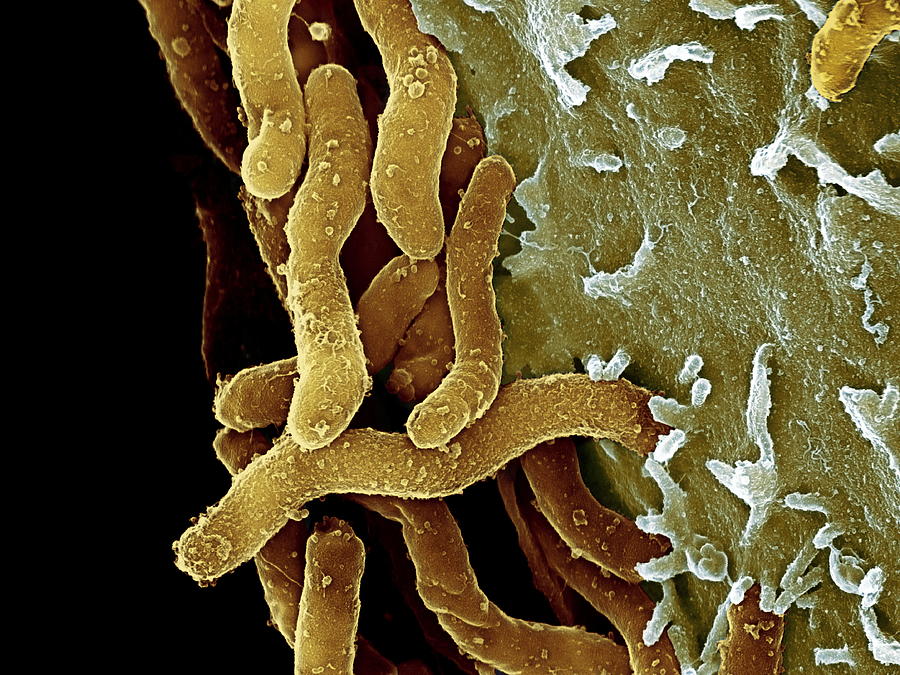 Helicobacter Pylori Photograph - Helicobacter Pylori Bacteria, Sem #9 by 