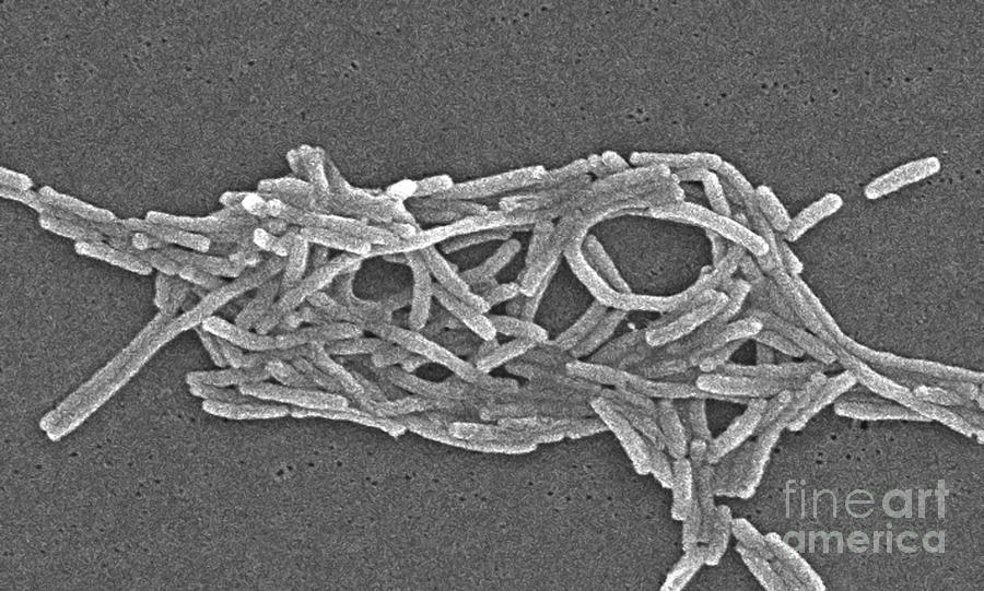 Scanning Electron Micrograph Photograph - Legionella Pneumophila #9 by Science Source