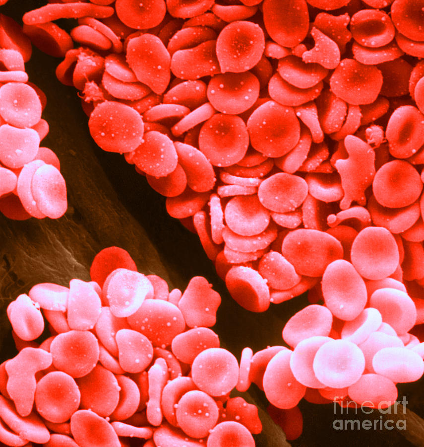 Red Blood Cells Photograph - Red Blood Cells, Sem #9 by Omikron