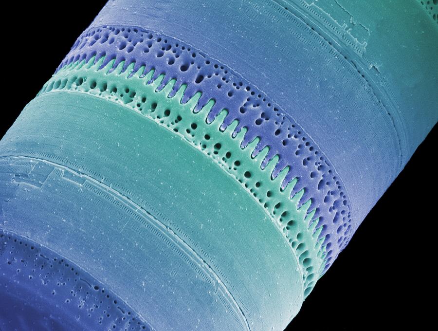 Nature Photograph - Diatom, Sem #99 by Steve Gschmeissner