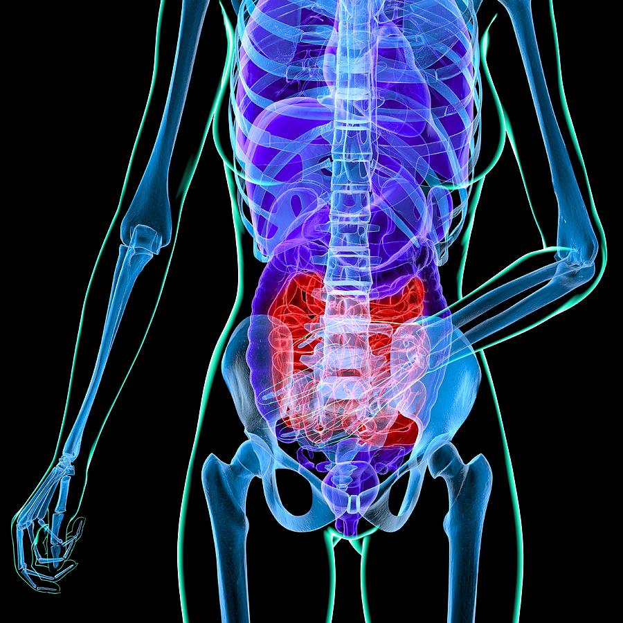 Abdominal Pain Conceptual Artwork Digital Art By Roger Harris Fine Art America