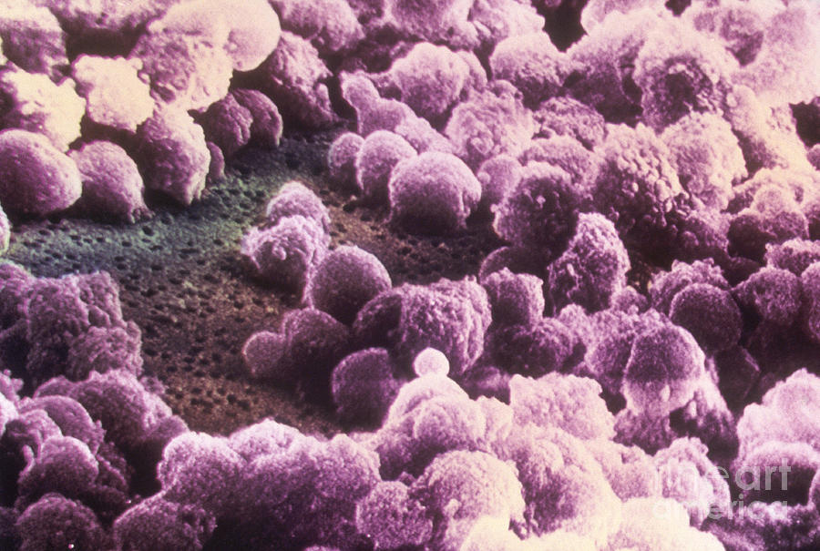 Medical Photograph - Aids Virus Sem by Science Source