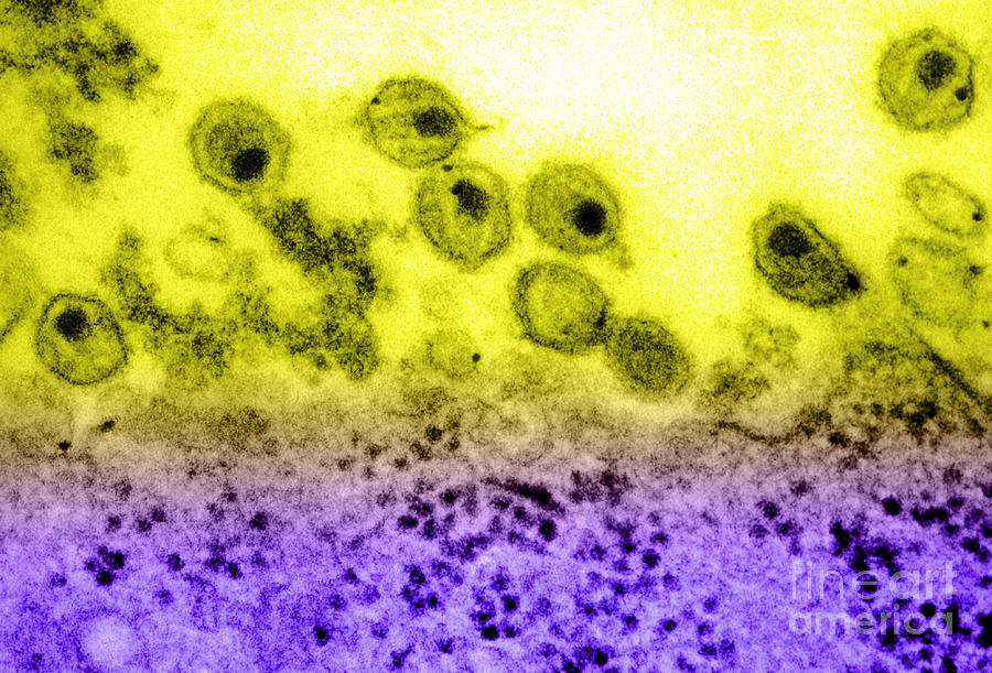 Aids Virus, Tem Photograph by Science Source