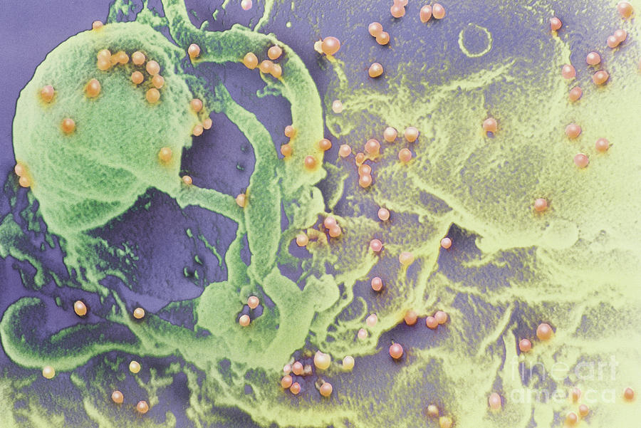 Aids Viruses Photograph by Science Source