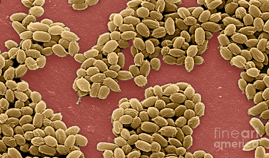 Anthrax Bacteria, Sem Photograph by Science Source