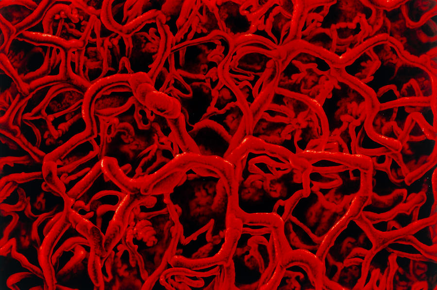 Artwork Based On Sem Of Microcapillary Network Photograph By Francis Leroy Biocosmos Fine 5314