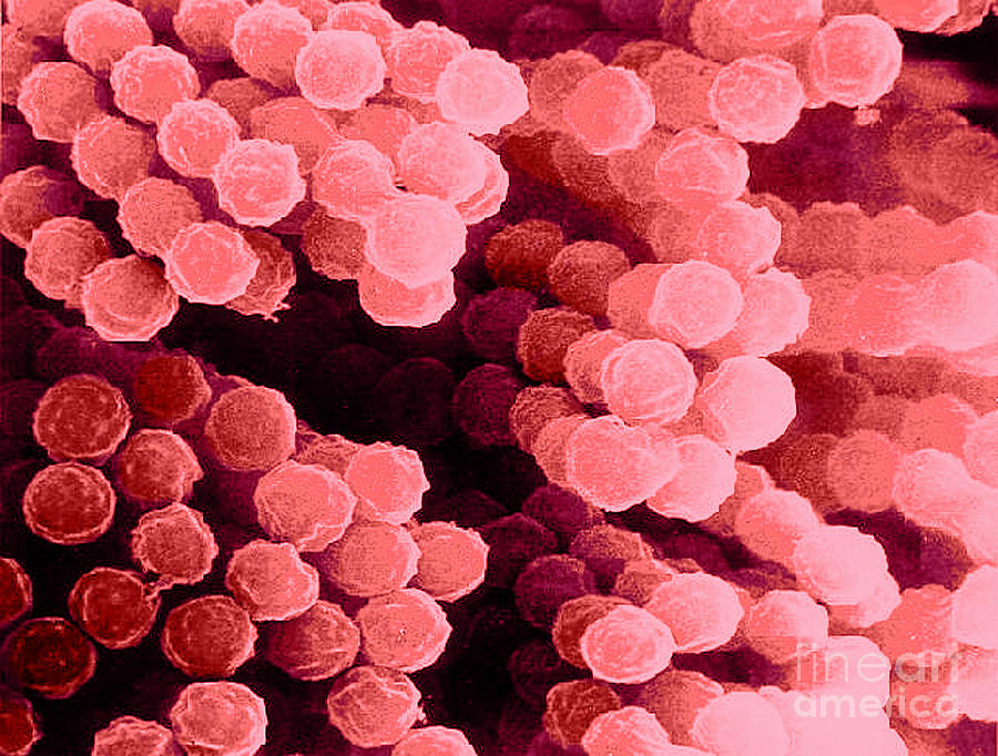 Aspergillus Photograph by Science Source