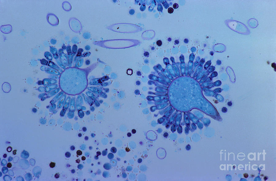 Biology Photograph - Aspergillus Spores Lm by M. I. Walker