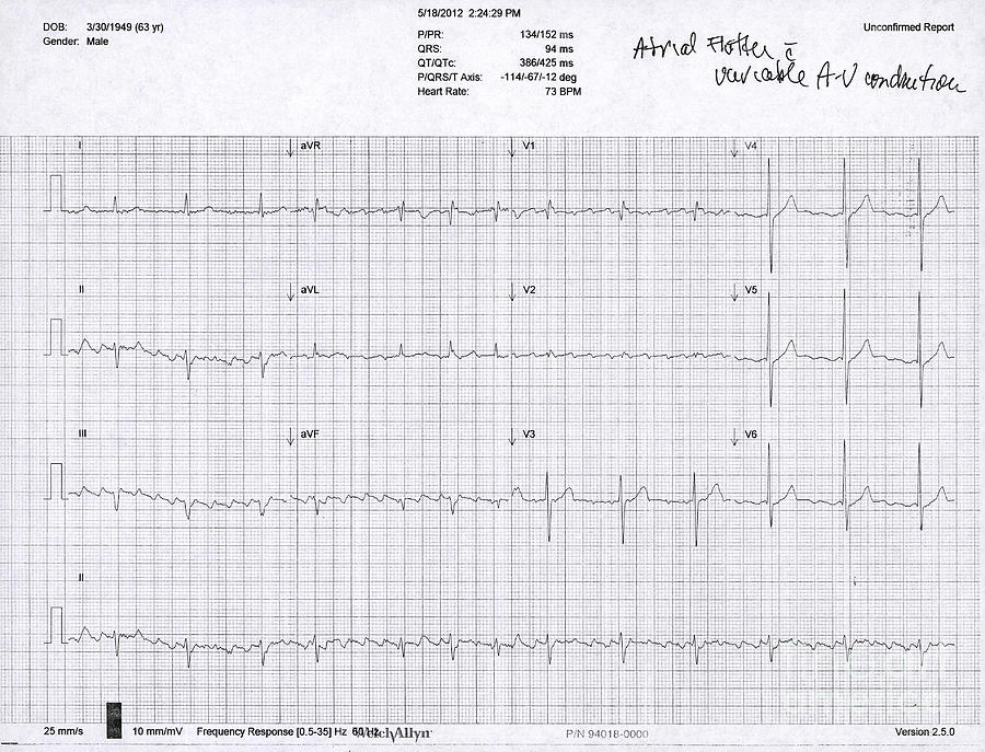 Atrial Flutter Ecg Photograph By Science Source