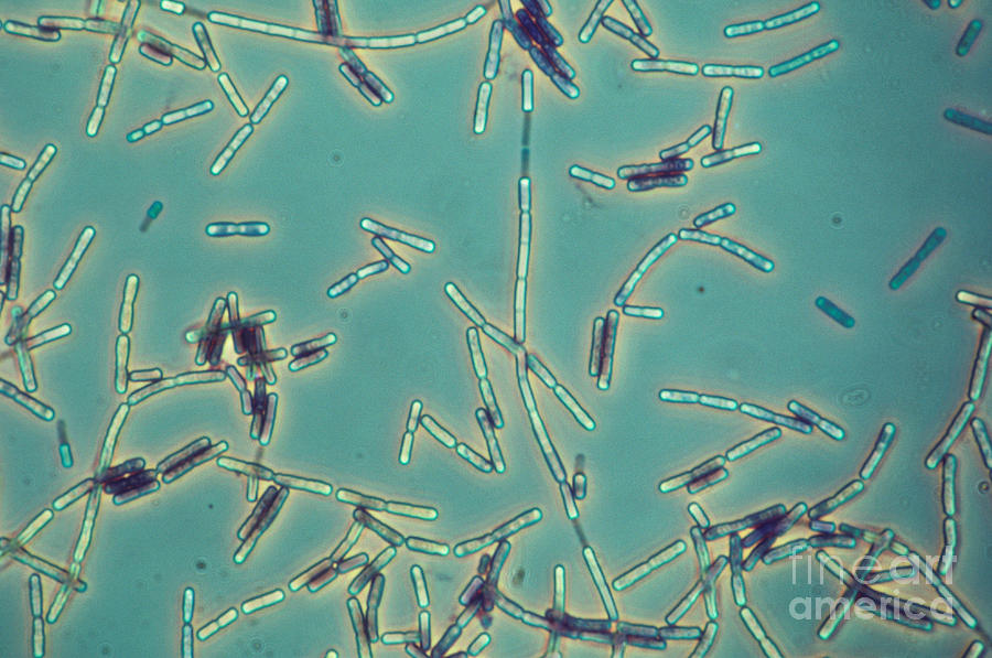 Bacillus Anthracis Photograph by M. I. Walker