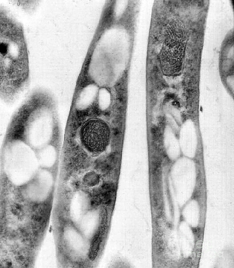 Bacillus Anthracis, Tem Photograph by Science Source