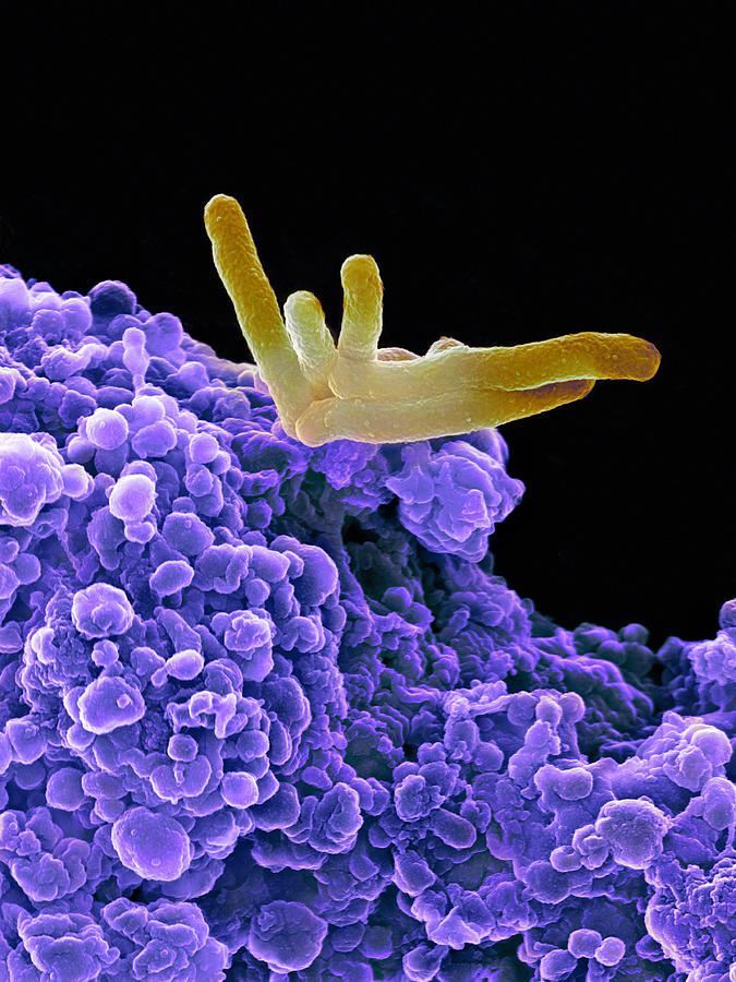 Mycobacterium Tuberculosis Photograph - Bacteria Infecting A Macrophage, Sem by 