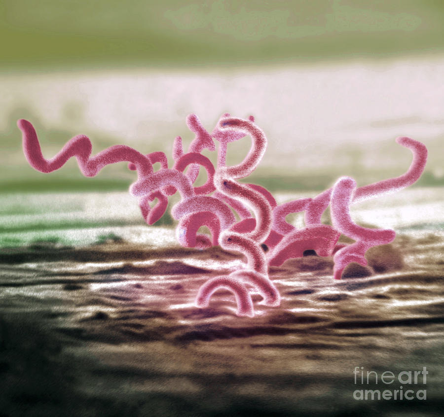 Bacteria, Treponema Pallidum, Sem Photograph by Science Source