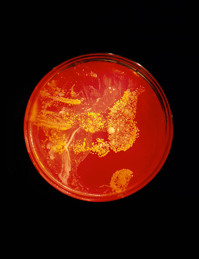 Bacteriology Photograph - Bacterial Colonies by Volker Steger