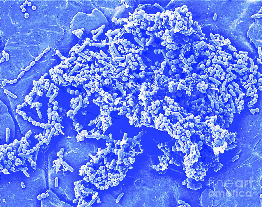 Bacteria Photograph - Bacterial Composite by Science Source