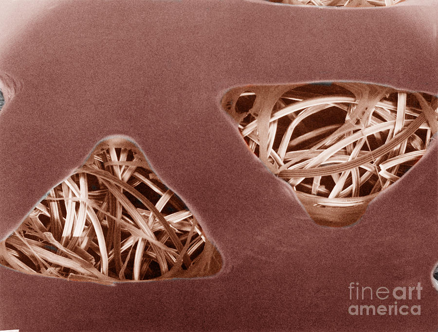 Bandage Photograph by Science Source