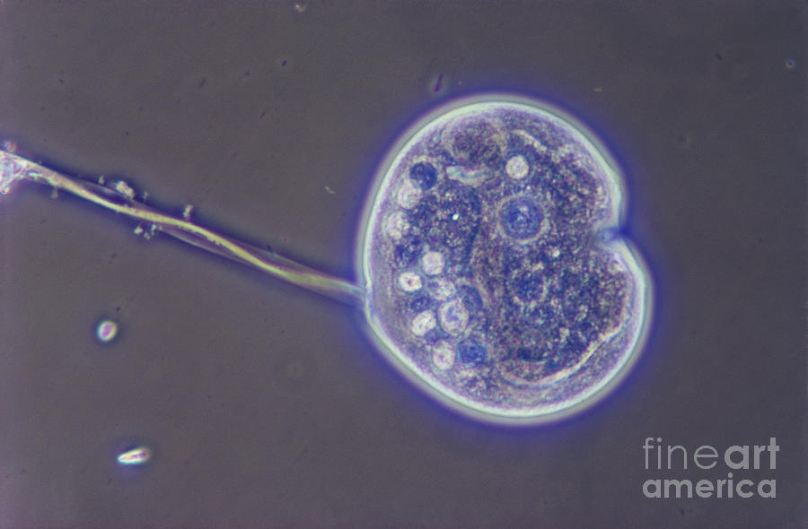 Science Photograph - Binary Fission In Vorticella Lm by M. I. Walker