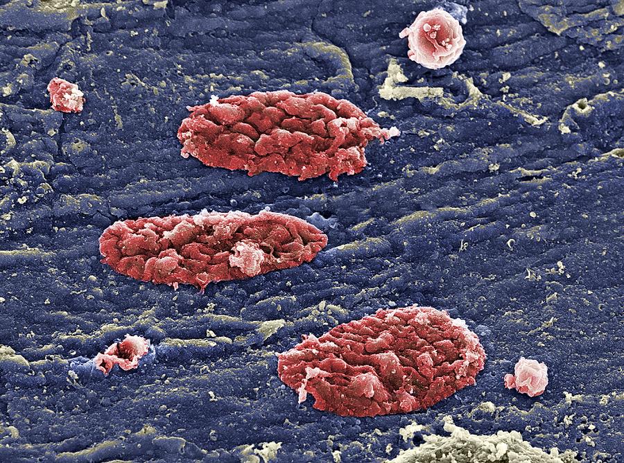 Blood Clots, Sem Photograph by - Fine Art America