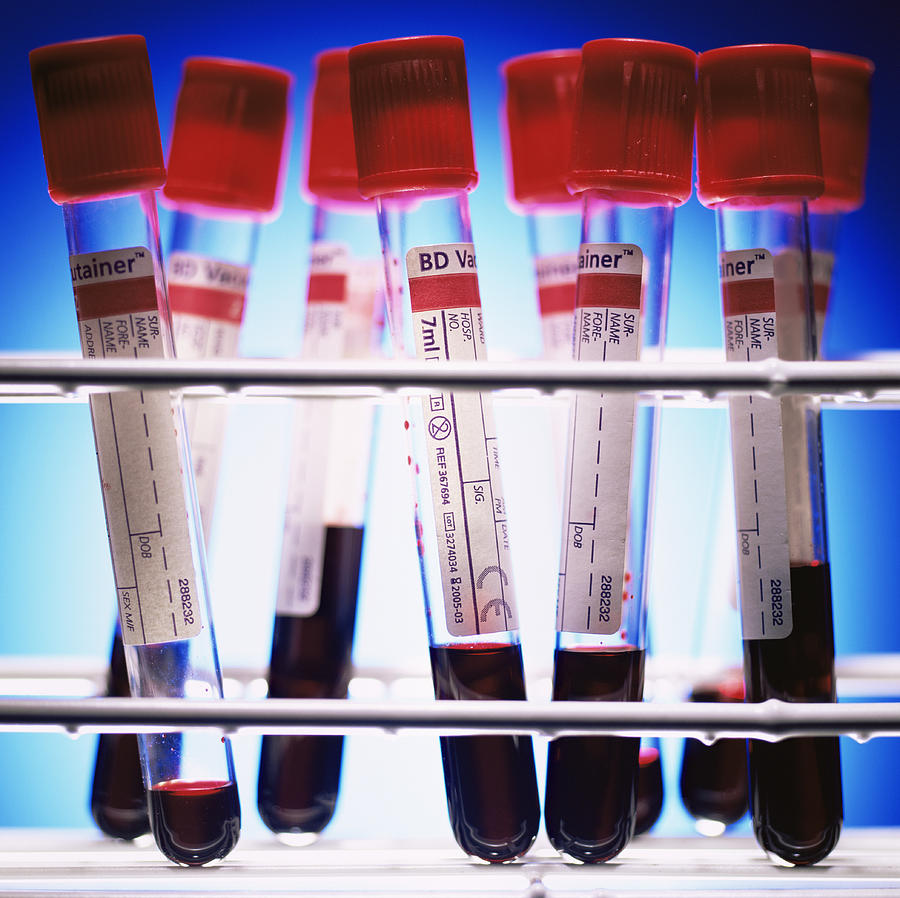 Rack Photograph - Blood Samples by Kevin Curtis