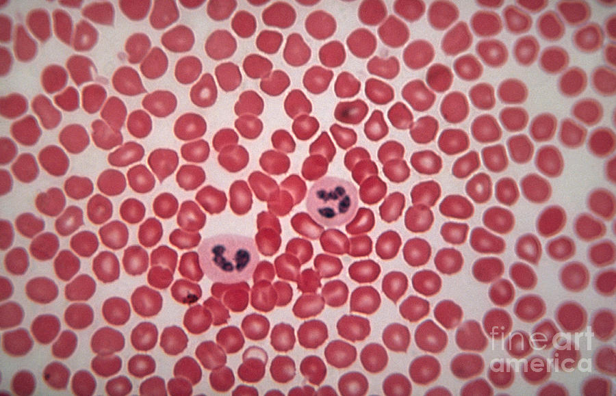Blood Smear Photograph by Eric V. Grave