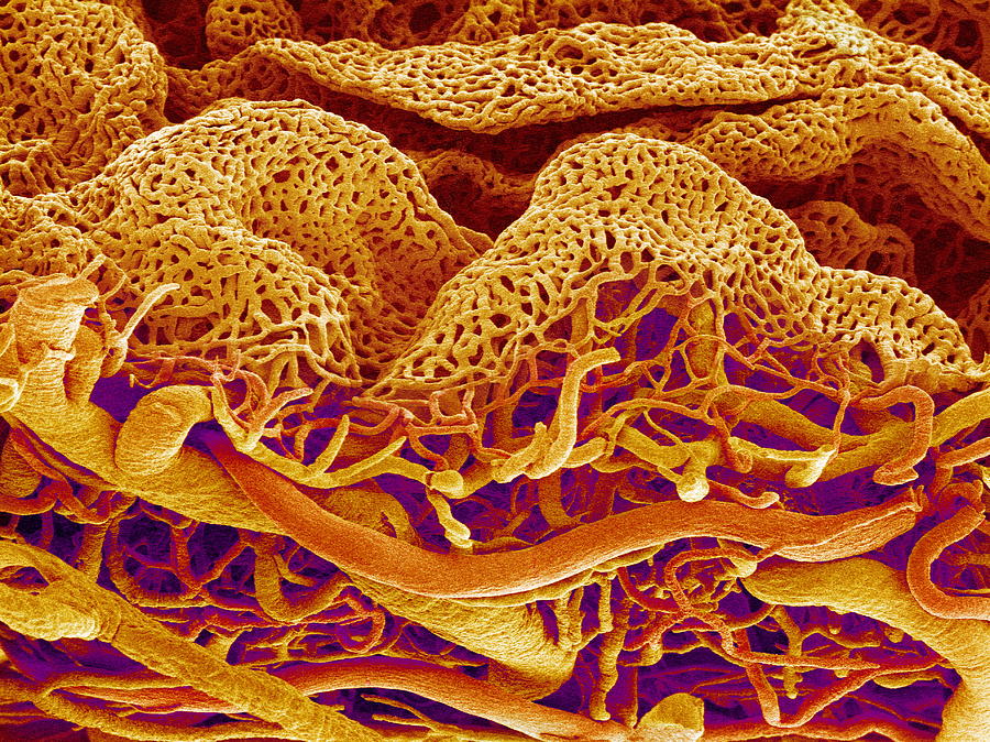 Blood Vessels Of The Small Intestine Photograph by Susumu Nishinaga