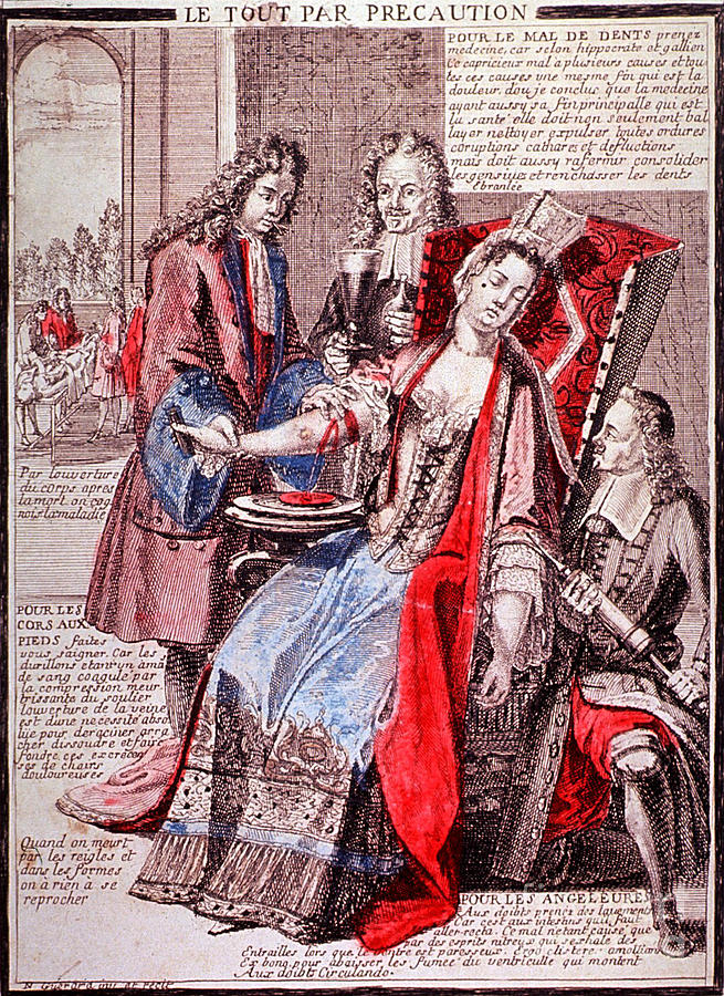 Bloodletting, 17th Century Photograph by Science Source