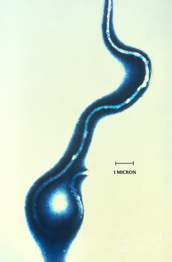 Borrelia Burgdorferi Lyme Disease Photograph by Science Source
