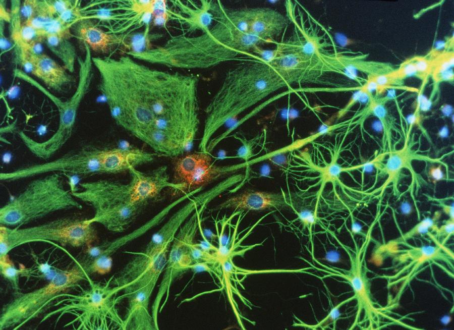 Images Photograph - Brain Cells by Nancy Kedershaucla