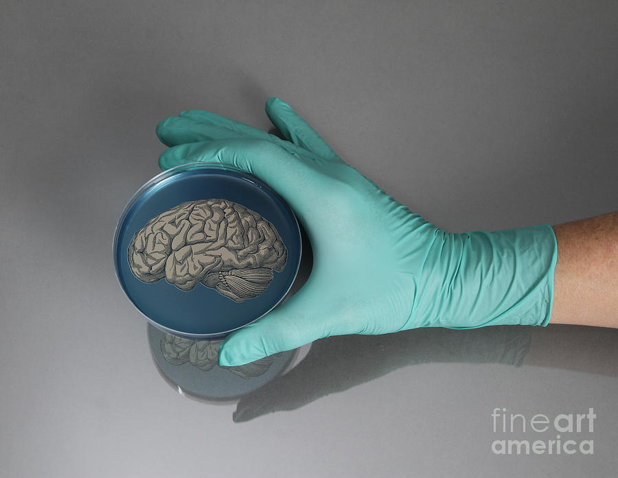 Brain In A Petri Dish Photograph by Photo Researchers